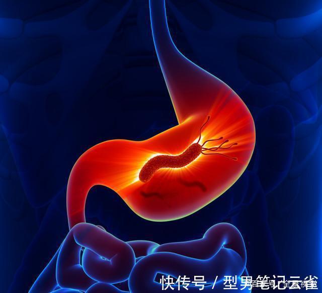 肠胃疾病|幽门螺杆菌超标,身上1处会臭,4个信号出现,胃已“千疮百孔”