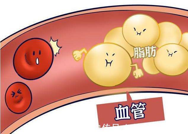 王大爷|57岁大叔,每天吃洋葱降血脂,一段时间后他的血脂有啥变化?