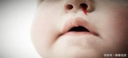母乳|2个月大女婴喝母乳后流鼻血身亡，真相揭开让人痛心不已