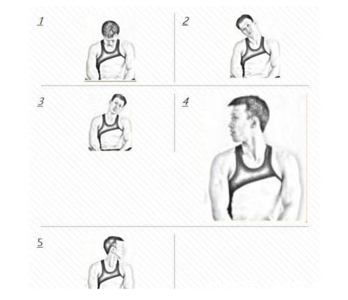 脊髓|颈椎,为何为“百病之源”!颈椎病分10级,超过2级就要注意了