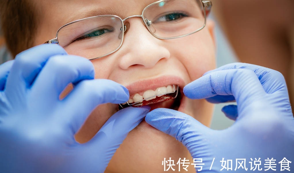 正畸|儿童做牙齿矫正三个最佳时间家长要牢记，矫治越早干预效果越好