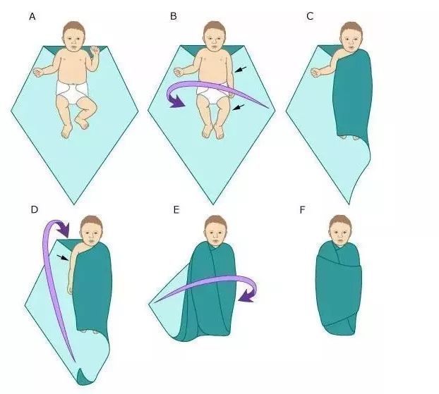 硬膜外血肿|孕妈客厅散步,宝宝突然“钻”了出来,头朝地摔在地上,万幸!