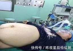 孩子|准妈妈总感觉肚里怀的不是孩子,孩子出生后,全家人都惊呆了!