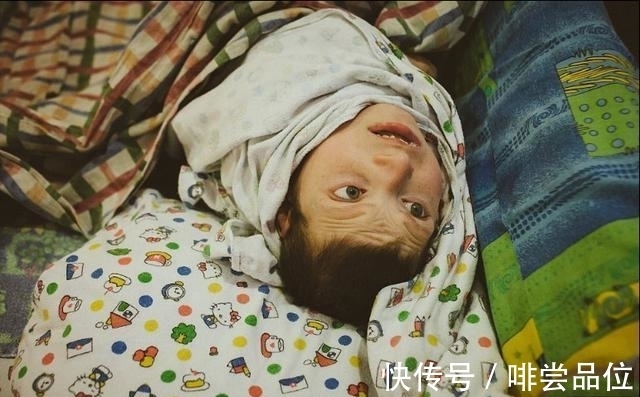 营养不良|孤儿院的厨娘长得又白又胖, 孤儿们严重营养不良骨瘦如柴