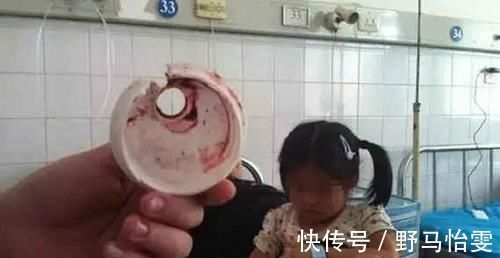 妈妈|妈妈送的生日礼物,差点致使5岁女童被“割掉舌头”