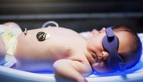 小陈|新生儿出生有黄疸,跟孕妇这些习惯有关,中招的孕妈赶紧改掉