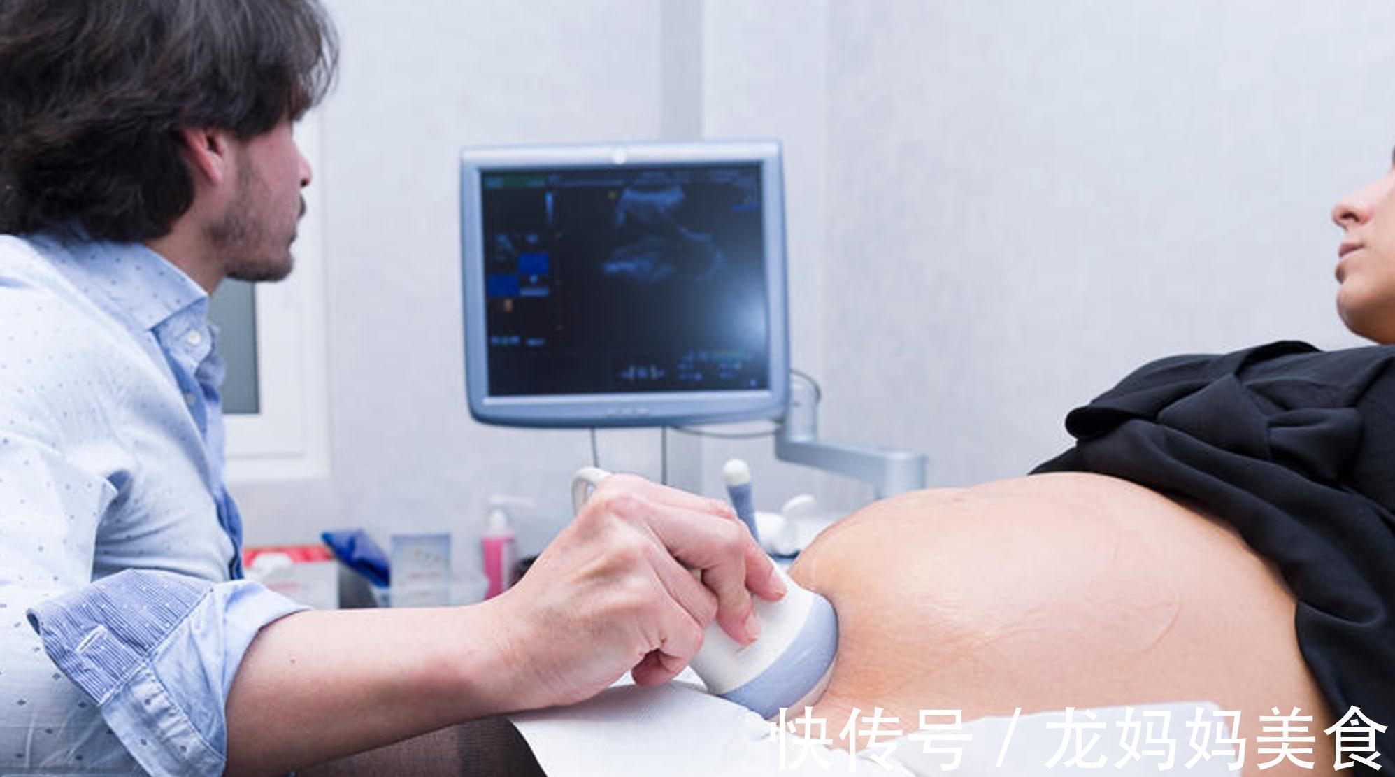 B超|B超、彩超、三维彩超、四维彩超,孕妇究竟该怎么选?一次性说清