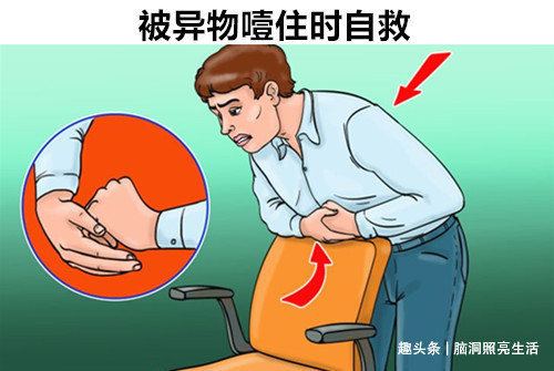 在千钧一发的危急时刻，可以拯救你生命的10个生存技巧