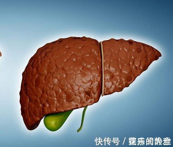 皮肤瘙痒|肝硬化的早期,可能会出现4个症状,早看早知早治疗