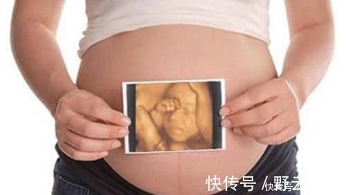 胎儿|孕妇做B超,为什么医生要涂一层黏乎乎的胶体,说出来你可能不信