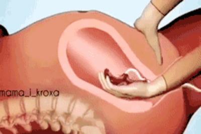 孕妈们|九个“产房行话”,产妇有必要提前了解,生孩子时不尴尬无压力