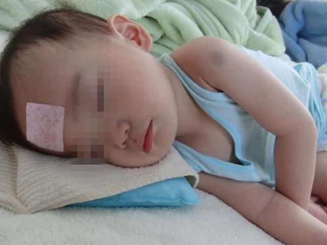 奶奶|2岁孩子患上败血症，医生说出原因后，奶奶直呼是自己害了娃