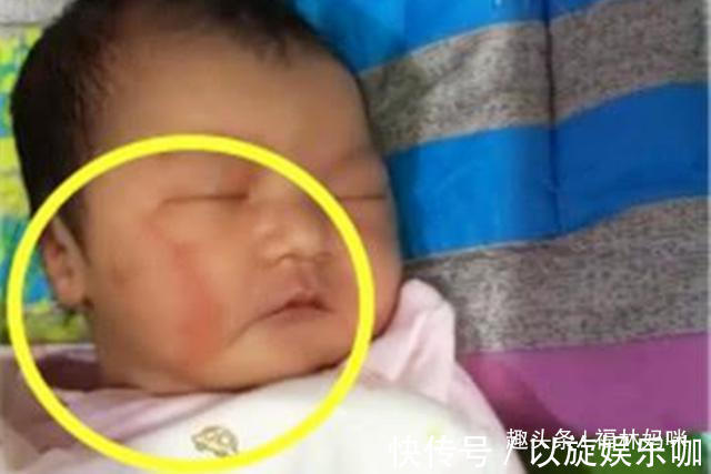 姿势|“大夫，我能换个姿势吗？”宝妈这句话，为宝宝免去“产钳”之苦