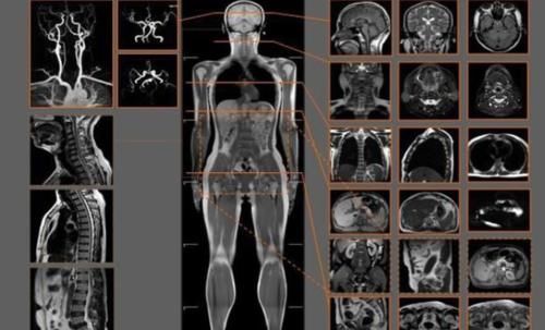准确性|为什么说“磁共振”尽量不要做？若检查时需注意3点，看完就懂了
