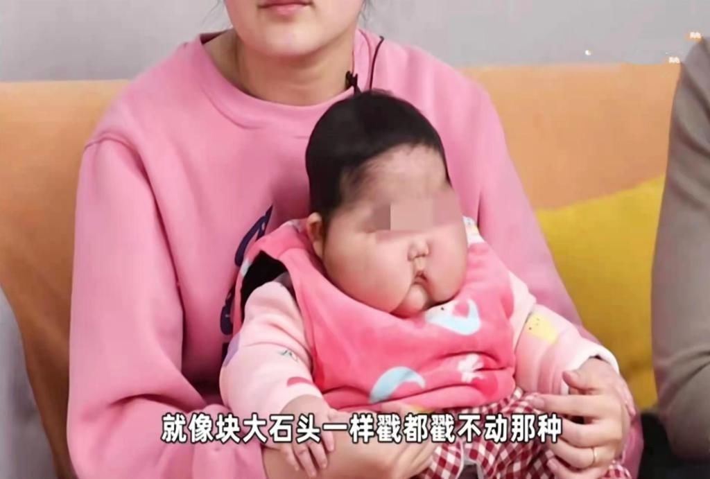 大头|新生儿两个月变“大头宝宝”,背后“凶手”竟是婴儿霜