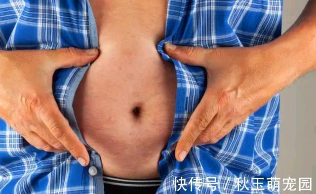 肚子疼!肚脐眼里的“泥”到底是啥?能不能抠?显微镜放大1000倍,真酸爽