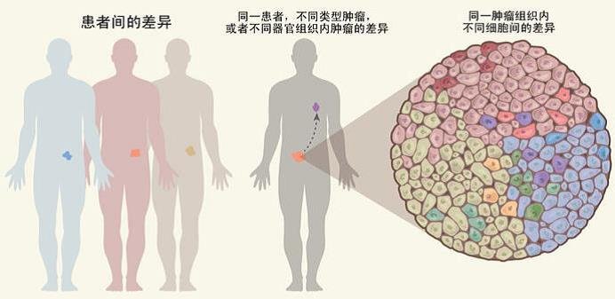 胰腺癌|培养皿中种出肿瘤，为癌症患者打开希望之门！