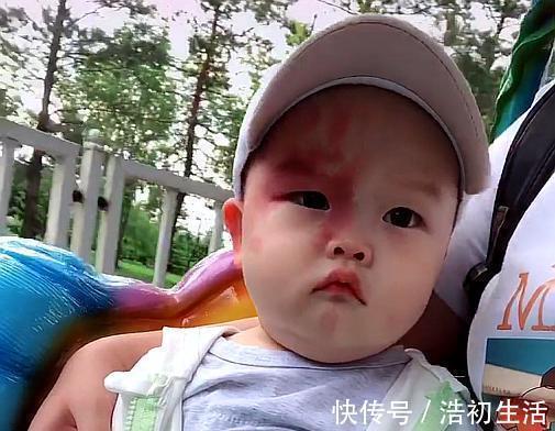 宝宝|孕期这三个行为,容易让胎记找上宝宝,准妈妈需尽量避开