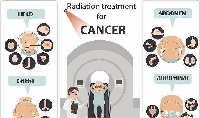 信号|“宫颈癌”来临前，身体一般会发出3个“信号”！