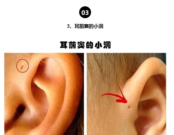 等位基因|罕见的身体特征只有少数人身上才拥有的10个罕见的特征