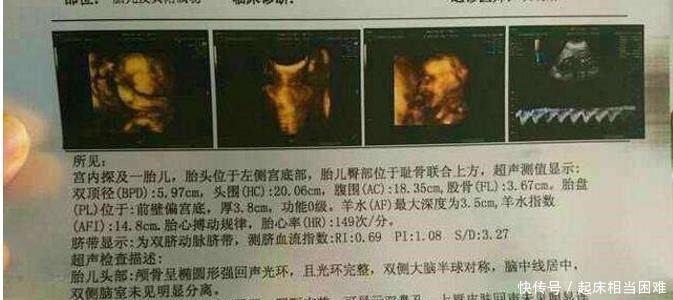 胎心率|准妈若怀有小阿哥，做B超时会有哪些数据不妨验证一下吧！