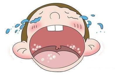 灼烧感|宝宝口腔溃疡了怎么办预防远比治疗更重要,父母学起来