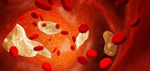 胡萝卜素|血管一堵,百病缠身! 多吃这5种食物,能清血管,身体更健康