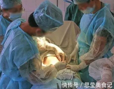 小牛奶|什么是备皮?什么是小牛奶?了解这些产房暗语,避免尴尬