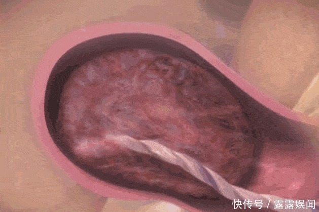 子宫|顺产到底有多疼,给你们看完这18图片,就能真正理解女人不容易