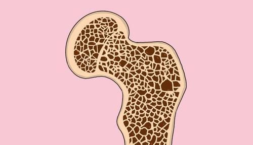 50岁后如何增强骨密度? 骨科医生告诉你具体做法，壮骨防疏松