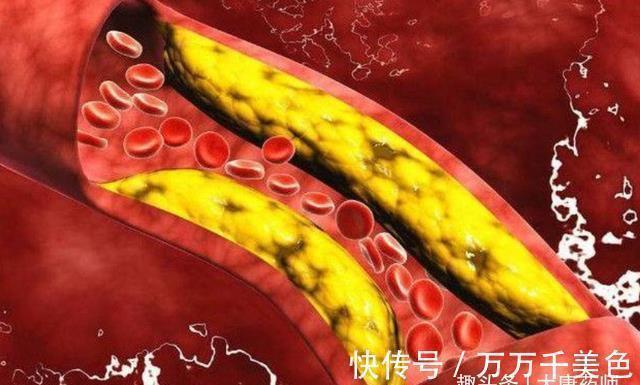 食物|高血压怕缺钾?医生建议:50岁以上的中年人,4种高钾食物要常吃