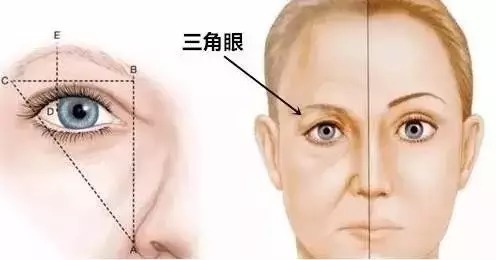 皱纹|衰老，为什么先从眼部开始？