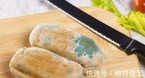 肝脏|请告诉父母:这些食物“多吃”会伤肝,几乎家家有,能少吃则少吃