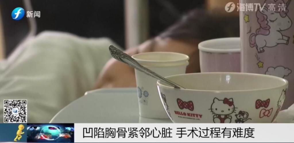  女童|5岁女童＂漏斗胸＂凹陷紧邻心脏，离脊椎不足5厘米！