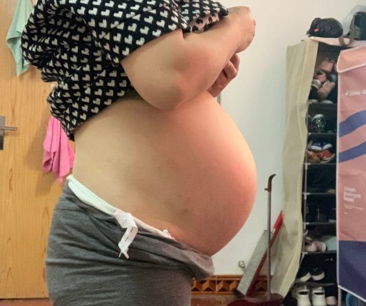 胎儿在宫内|准妈妈犯小错误,孕中期胎盘剥离,胎儿被引产