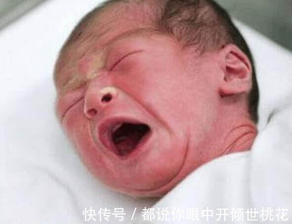 酸性|孩子出生后出现黄疸,多半是孕期时的坏习惯导致,要留心!