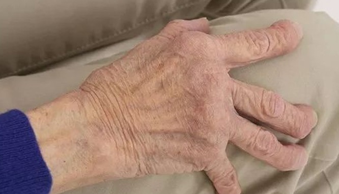 忽悠|5种病无法根治!忽悠能根治是骗你,莫轻信谣言,搞得人财两空!