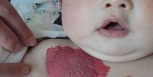 饮食习惯|怀孕期间要注意的几个事项, 否则宝宝会长胎记, 尤其是第2个