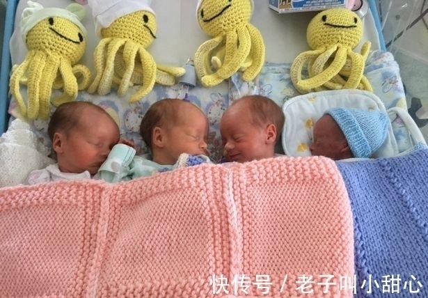 洛根|70万分之一!英国最小四胞胎弟弟出生仅1.2斤,住院9个月后迎来生日