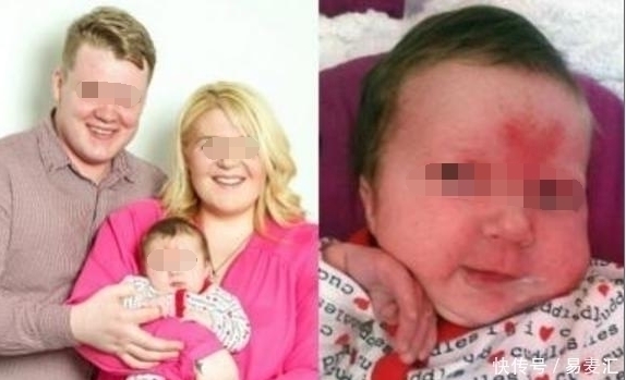 斯帕汉|小伙儿情人节为女友种草莓,意外怀孕,生下宝宝头上的胎记亮了