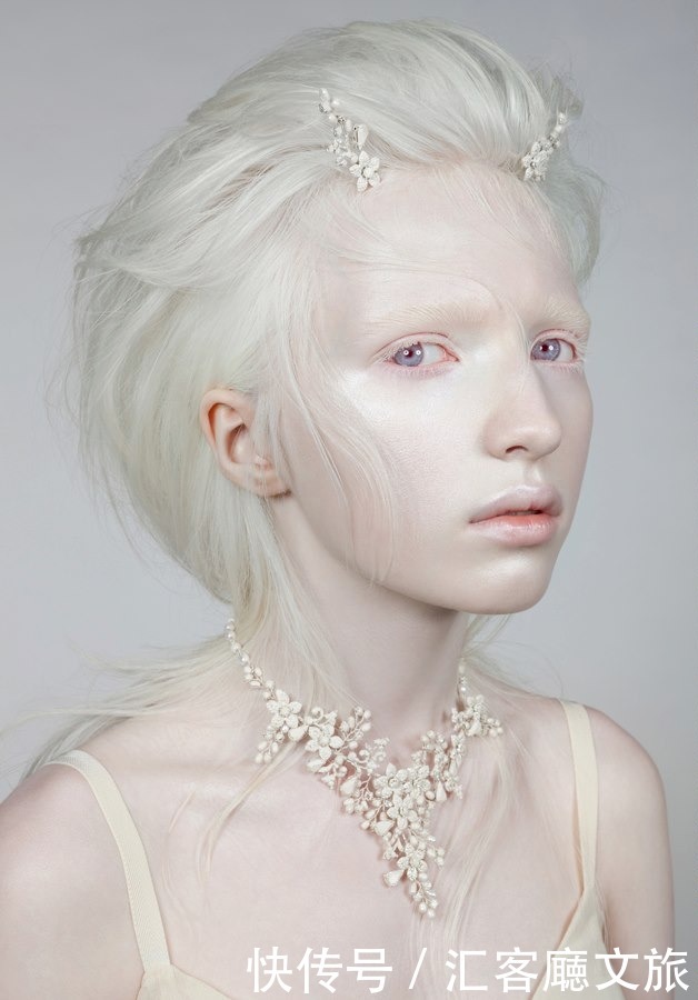 逆袭|因“全身雪白”被遗弃的中国女孩,逆袭成超模的故事让人泪目