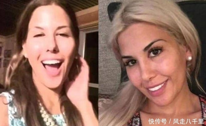 整容|女子花重金整容,一年经历13次整容手术,整容前后判若两人