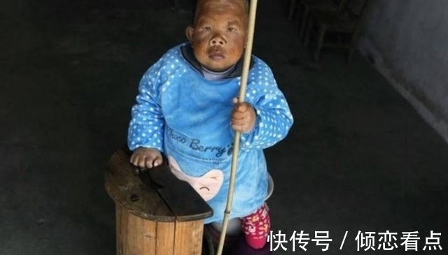 智力障碍|身体像3岁大婴儿却已活了30年,从未叫过一声妈,真相让人落泪