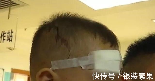 小孩|吓坏家长! 孩子早上起来满脸是血, 医生 已收治十多名同情况小孩