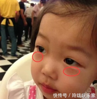 健脾|一旦发现孩子出现7个表现,说明脾胃已经“弱爆了”,及时健脾