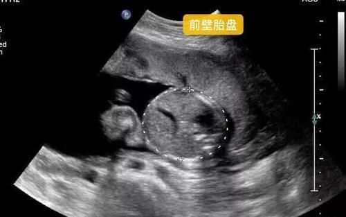21周胎动不明显正常吗 21周胎动不明显正常吗