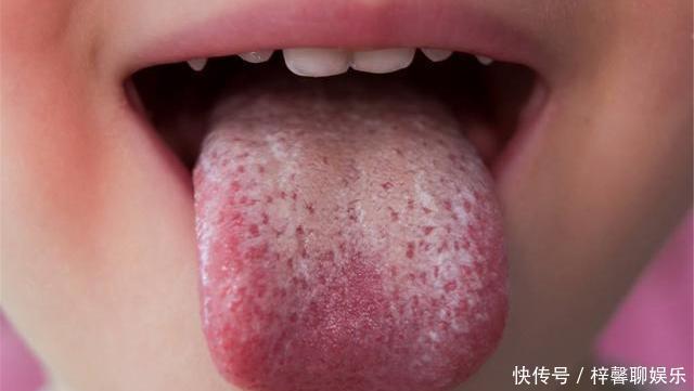 脾虚百病生，脾虚的人有哪些症状记住3个妙招，脾胃慢慢变强大