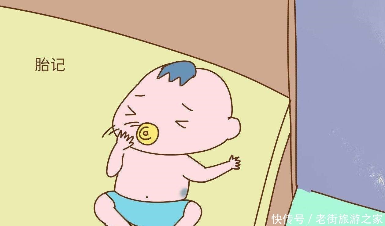 孕妈若有4个行为,胎儿脸上容易留胎记,别让宝宝长大自卑