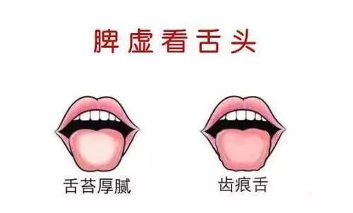 脾虚的人这三个表现很明显,做到这两点,脾胃也会慢慢变好