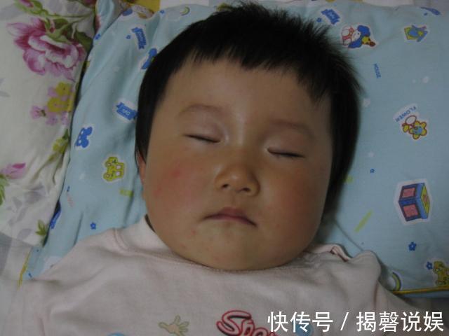 皮疹|宝宝出现9个特点,可能是患急疹了,教你5个方法,在家就能护理